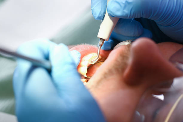 Best Emergency Treatment for Oral Infections in Herricks, NY